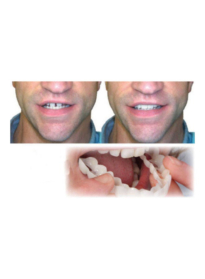 Teeth Whitening Teeth Cover Perfect Smile Comfort Fit Flex Teeth Veneers